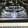 歯列矯正 レントゲン